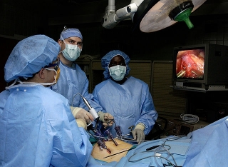 Laparoscopic stomach surgery